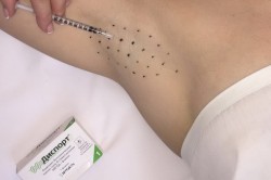 Инъекция в проблемную зону Инъекция в проблемную зону