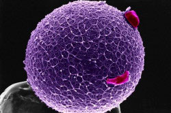 Яйцеклетка Яйцеклетка