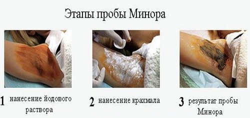 Этапы пробы Минора Этапы пробы Минора