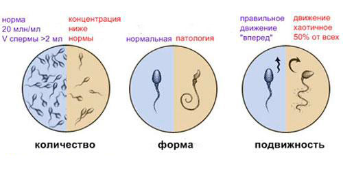 Качество спермы Качество спермы
