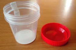 Забор спермы на анализ Забор спермы на анализ