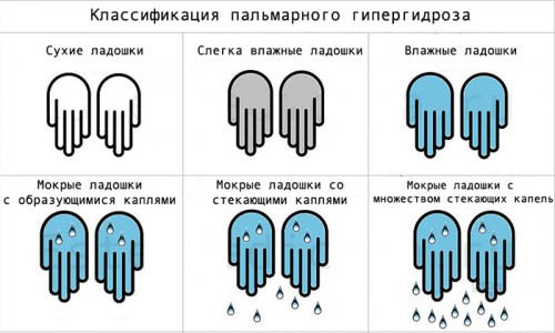 Классификация пальмарного гипергидроза Классификация пальмарного гипергидроза