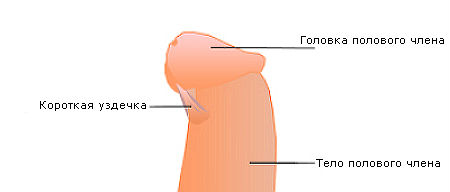 Короткая уздечка Короткая уздечка