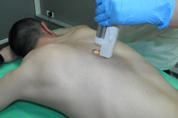 Лазерная эпиляция спины Лазерная эпиляция спины