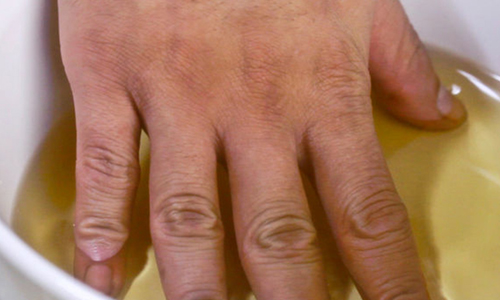 Лечение гипергидроза ладоней уксусом Лечение гипергидроза ладоней уксусом