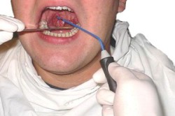 Лечение храпа Лечение храпа