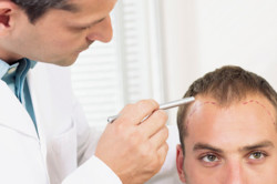 Облысение у мужчины Облысение у мужчины