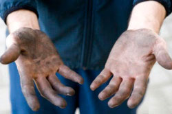 Нарушение правил гигиены Нарушение правил гигиены