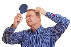 Облысение у мужчин Облысение у мужчин