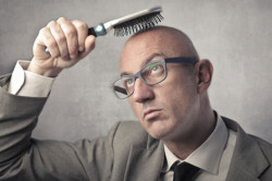 Облысение Облысение