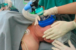 Общая анестезия Общая анестезия