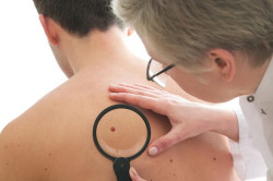 Осмотр дерматологом Осмотр дерматологом