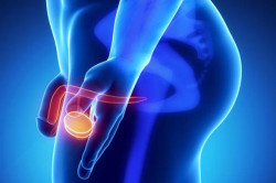 Острое воспаление придатков Острое воспаление придатков