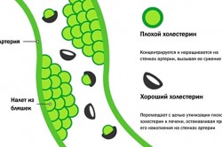 Отличия плохого холестирина от хорошего Отличия плохого холестирина от хорошего