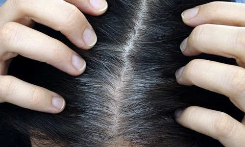 Появление седины Появление седины