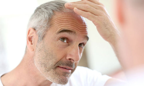 Появление седых волос Появление седых волос