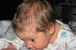 Потливость головы у детей Потливость головы у детей