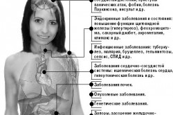 Потливость при заболеваниях