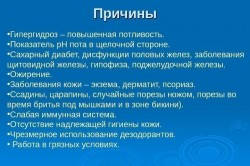 Причины гипергидроза Причины гипергидроза