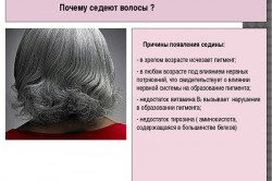 Причины седины Причины седины