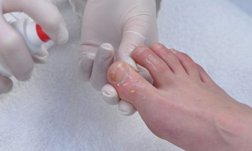 Применение спрея для ног Применение спрея для ног