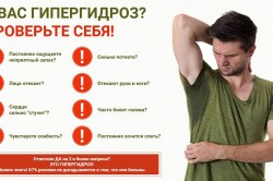 Признаки гипергидроза Признаки гипергидроза