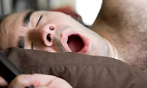 Проблема храпа Проблема храпа