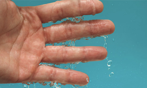 Проблема потливости ладоней Проблема потливости ладоней