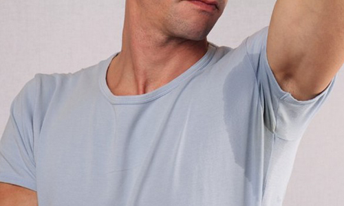 Проблема потливости подмышек Проблема потливости подмышек