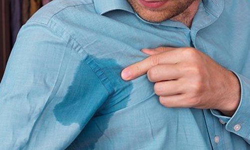 Проблема повышенной потливости Проблема повышенной потливости