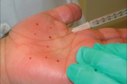 Процедура инъекции Процедура инъекции