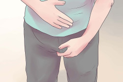 Проявление острого эпидидимита Проявление острого эпидидимита