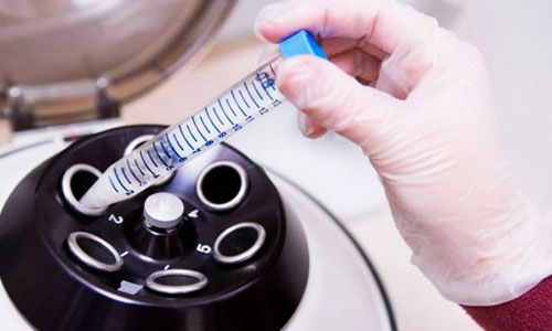 Проведение МАР-теста