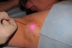 Проведение операции Проведение операции