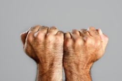 Пушковый гипертрихоз Пушковый гипертрихоз