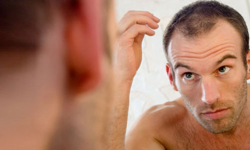 Раннее выпадение волос Раннее выпадение волос