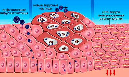 Распространение вируса ВПЧ Распространение вируса ВПЧ