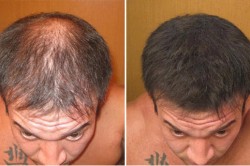 Результат применения у мужчин Результат применения у мужчин