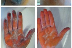 Результаты применения Драй Драй Результаты применения Драй Драй