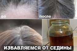 Результаты применения крапивы Результаты применения крапивы