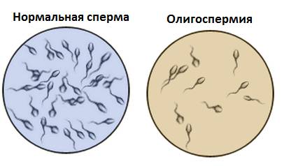 Состояние спермы Состояние спермы