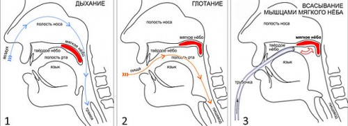 Схема храпа Схема храпа