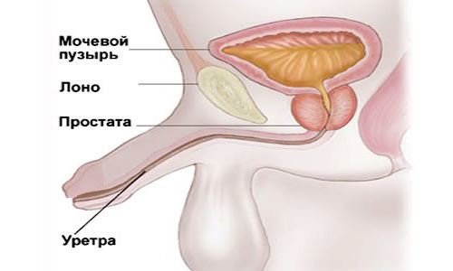 Схема уретрита Схема уретрита
