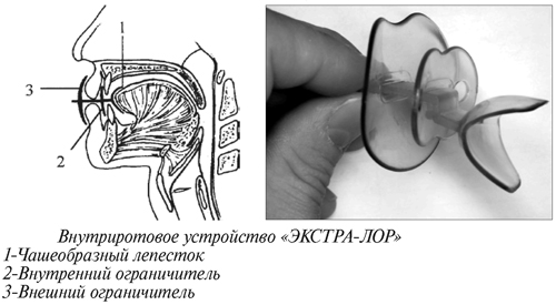 Схема устройства Экстра Лор Схема устройства Экстра Лор