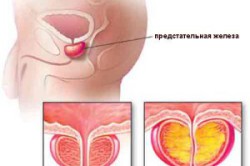 Консультация уролога Консультация уролога