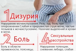 Симптомы простатита Симптомы простатита