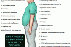 Синдром обструктивного апноэ сна Синдром обструктивного апноэ сна
