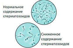 Содержание сперматозоидов Содержание сперматозоидов