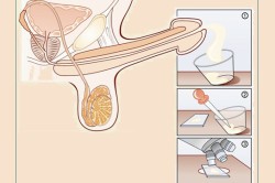 Спермограмма - анализ спермы Спермограмма - анализ спермы