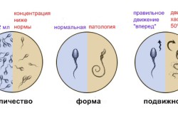 Результаты спермограммы Результаты спермограммы